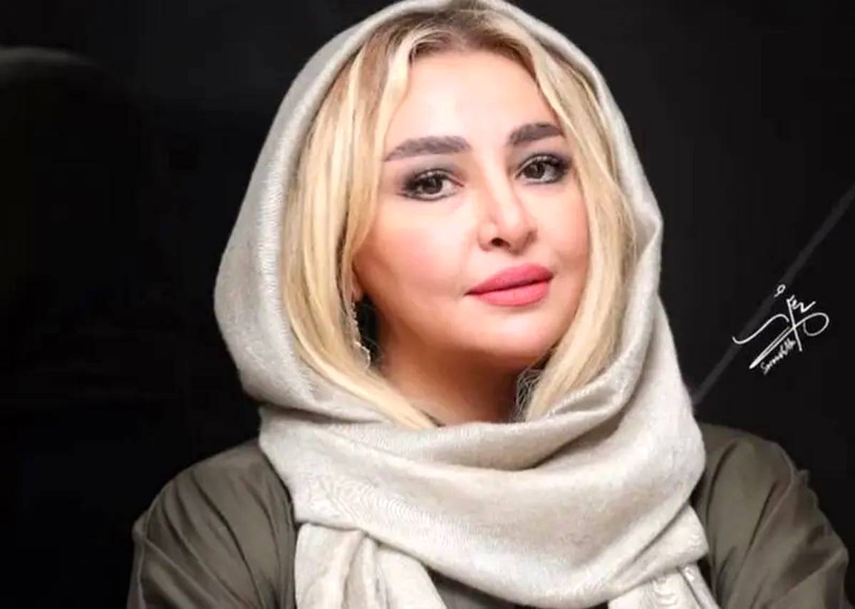 چهره متفاوت مهلقا باقری بعد از عمل زیبایی