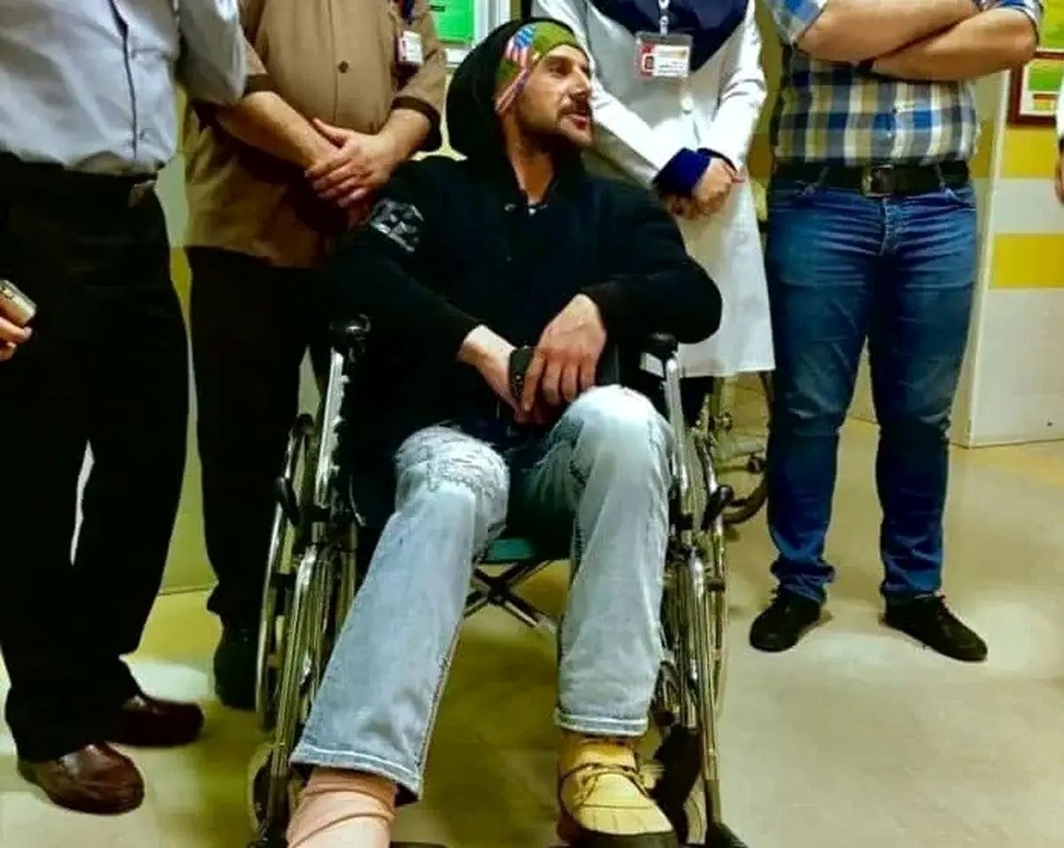 شکنجه‌های بازیگر شدن: از کاهش محسوس وزن، طلاق، قطع عضو تا پرت شدن از ارتفاع ۳ متری
