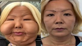 ترمیم چهره اینفلوئنسر معروف برزیلی پس از عمل زیبایی ناموفق